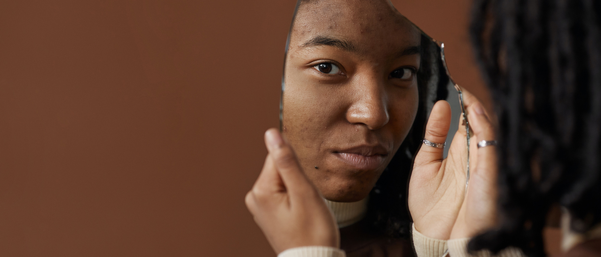 Pimple Myths